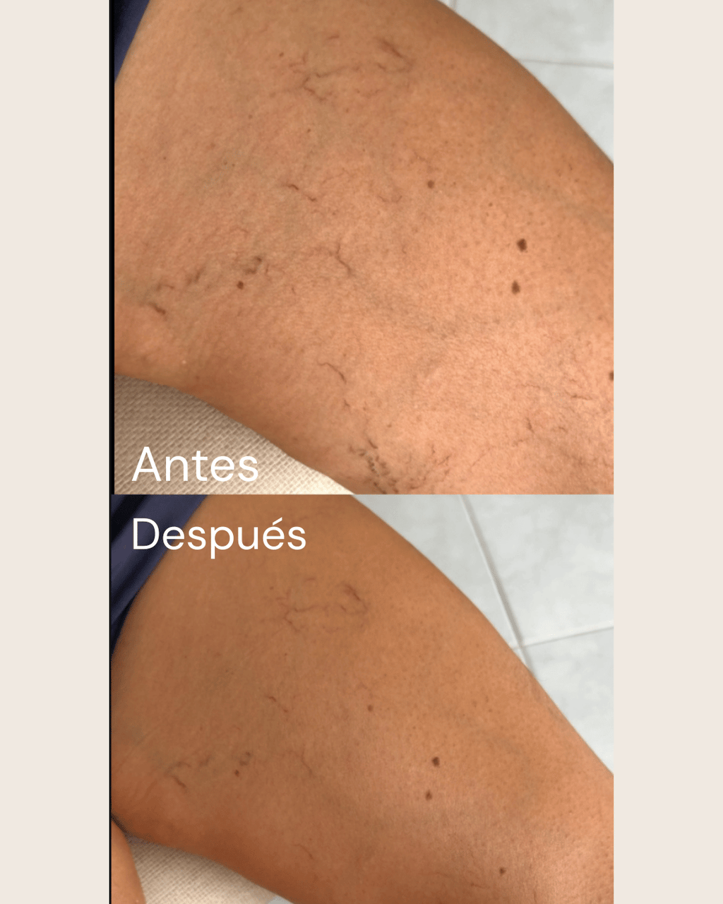 ESPUMA AUTOBRONCEADORA